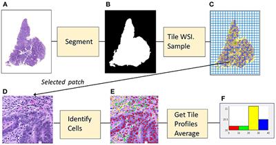 Deep Learning With Sampling in Colon Cancer Histology